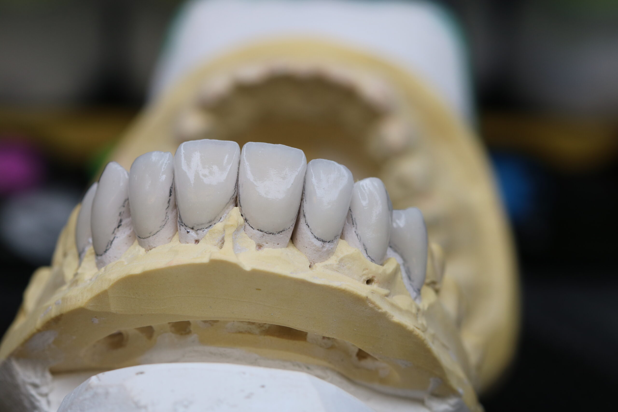 Praca ceramiczna — UP LAB PRO laboratorium Kielce